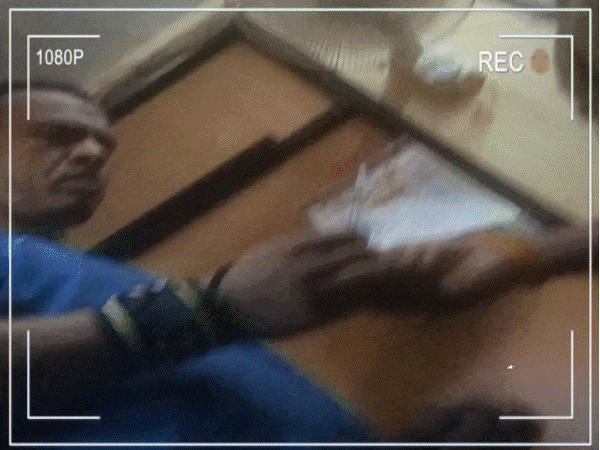 एमपी में ब्यूटी-फिटनेस का ‘खतरनाक’ कारोबार:डेंटिस्ट कर रहा ब्रेस्ट इंप्लांट सर्जरी, जिम ट्रेनर लगा रहा दुबला होने का इंजेक्शन; 2 लाख तक वसूल रहे